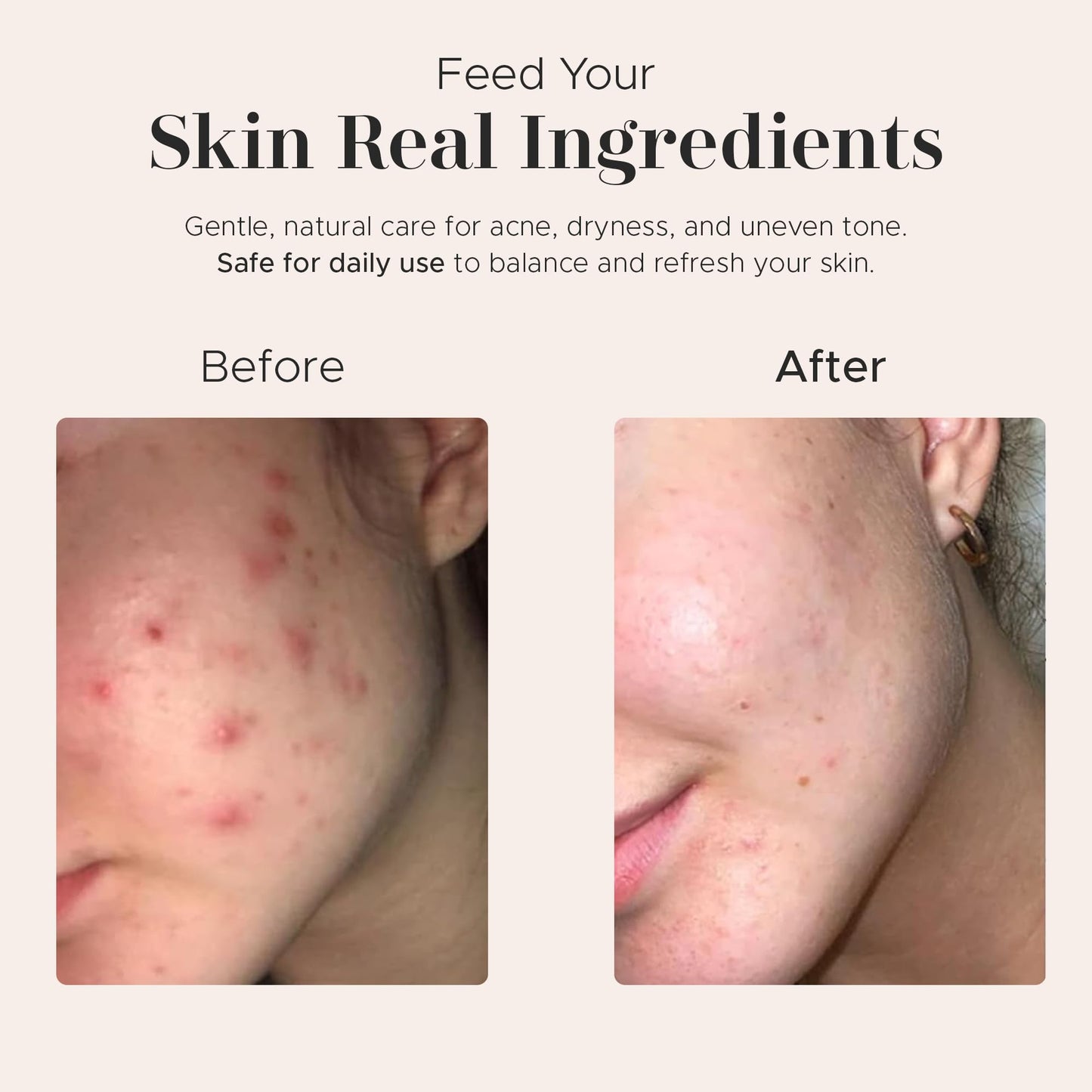 Raw African Black Soap Bar (8oz)